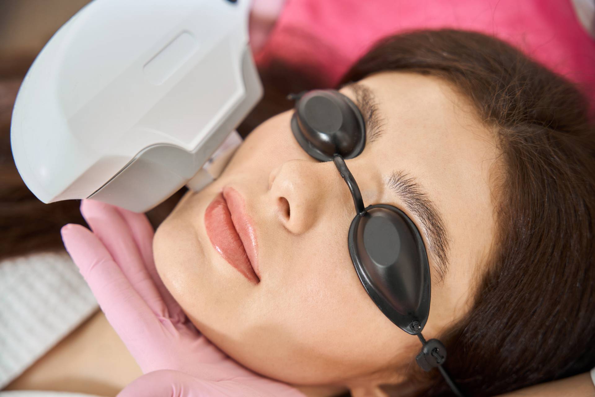 IPL Photofacial