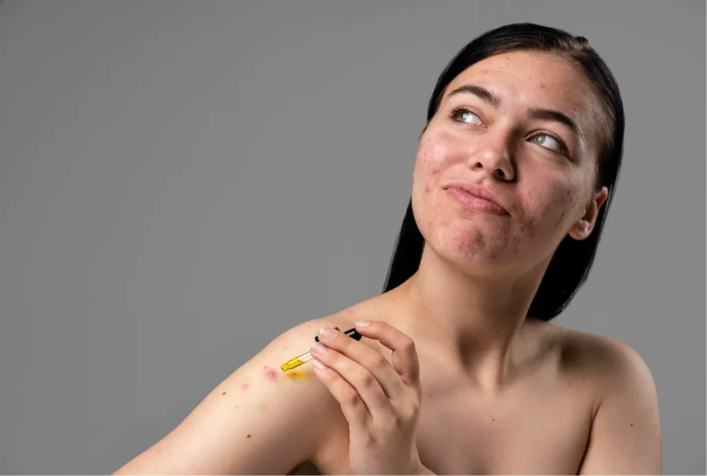 a photo of woman holding a treatment for her skin conditions Atomic Dermatology and Med Spa